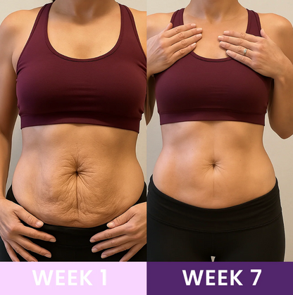 Waist Trainer | Lose Inches in Weeks